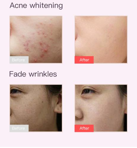 SQ10 | Full-Face Color Ritual Mask Multi-LED 8-Color LED Face Mask