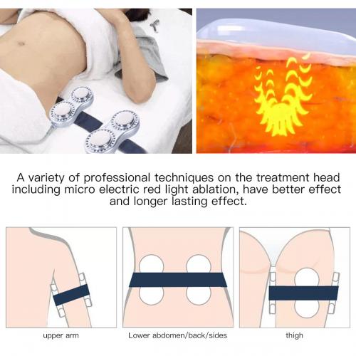 SQ47B Pro, 6in1 40K Cavitation Body Sculpting Device, Multi-Polar RF Vacuum EMS Laser for Body Contouring, Skin Smoothing & Face Skin Firming, US Plug
