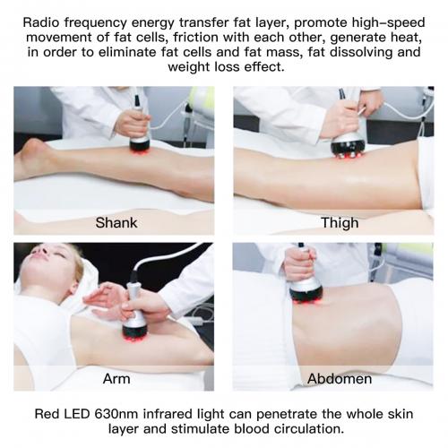 SQ47B Pro, 6in1 40K Cavitation Body Sculpting Device, Multi-Polar RF Vacuum EMS Laser for Body Contouring, Skin Smoothing & Face Skin Firming, US Plug