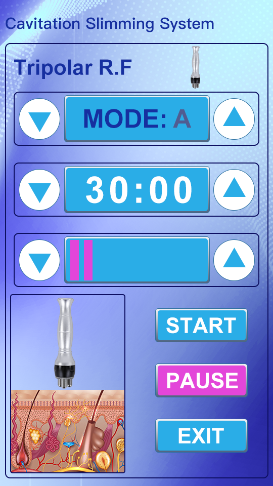 SQ16 touchscreen showing Tripolar RF function panel with Mode A selected
