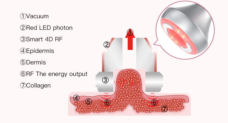 Vacuum RF technology diagram