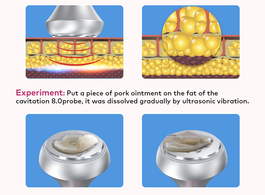 Cavitation fat dissolution experiment