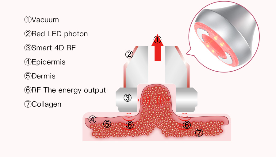 Vacuum RF working principle