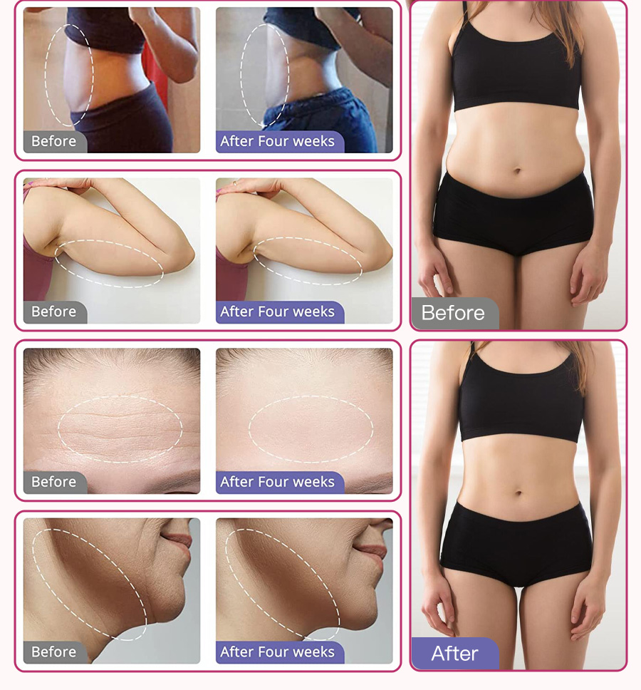 Real customer before and after results