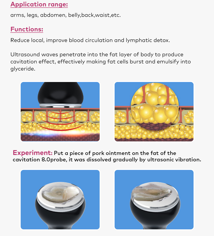Vacuum cupping and laser plate