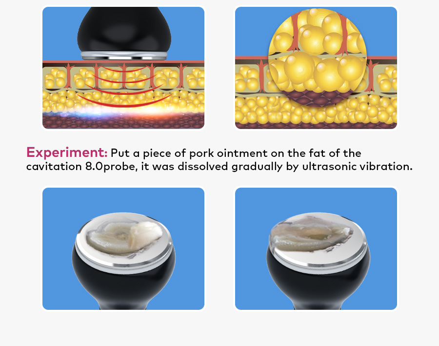 Body treatment operation guidance