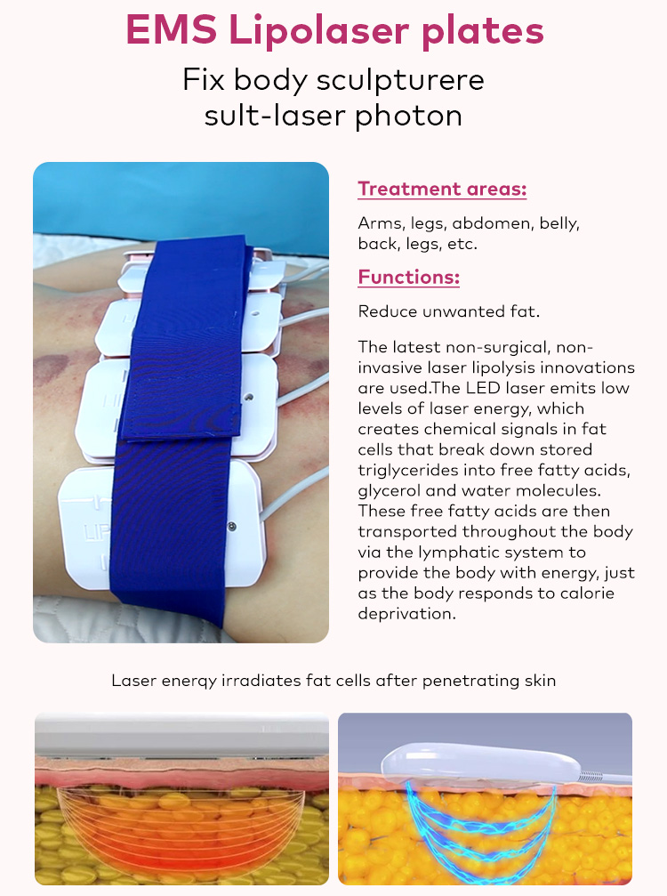 EMS Lipo Laser Plates