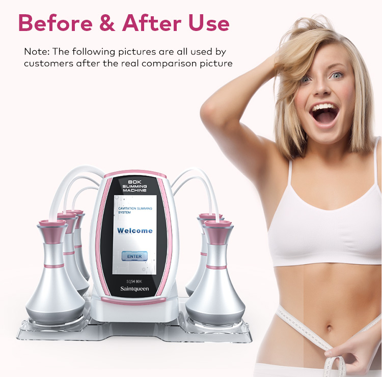 Before & After Use