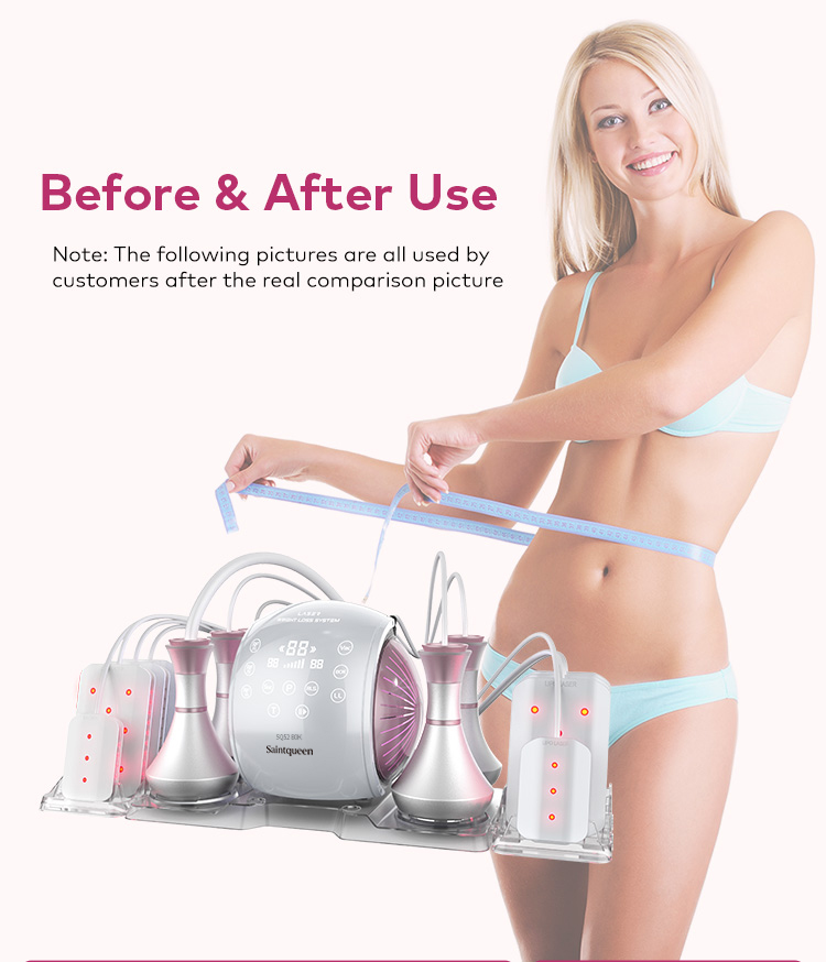 Body Sculpting Treatment Guide