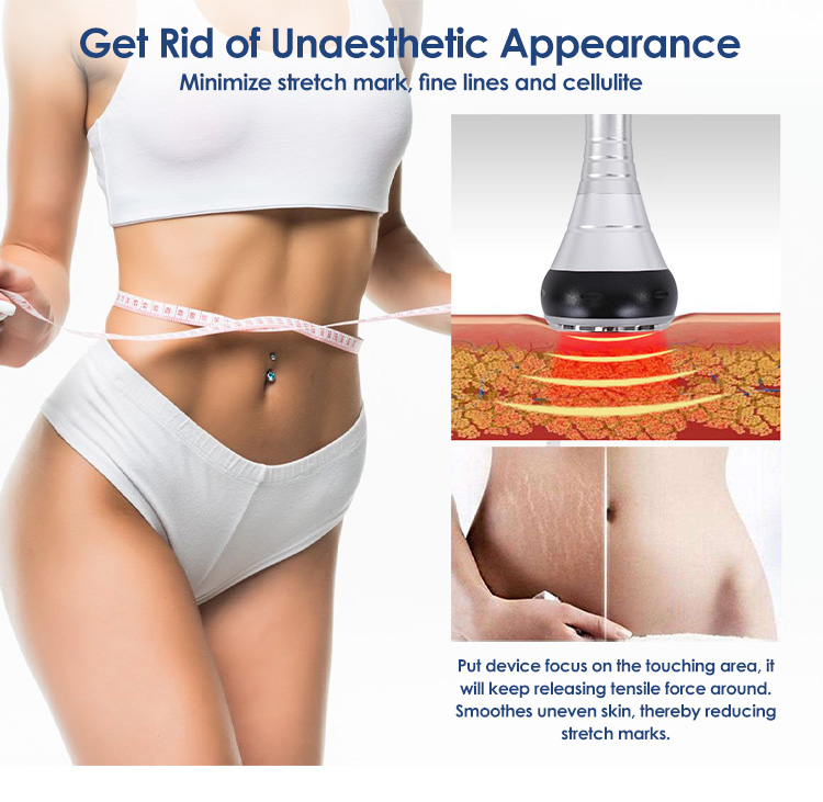 Multi-Polar RF Skin Tightening & Lifting
