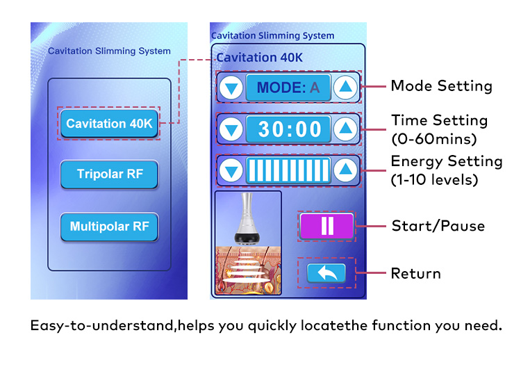 Tripolar & Tetrapolar RF Skin Firming