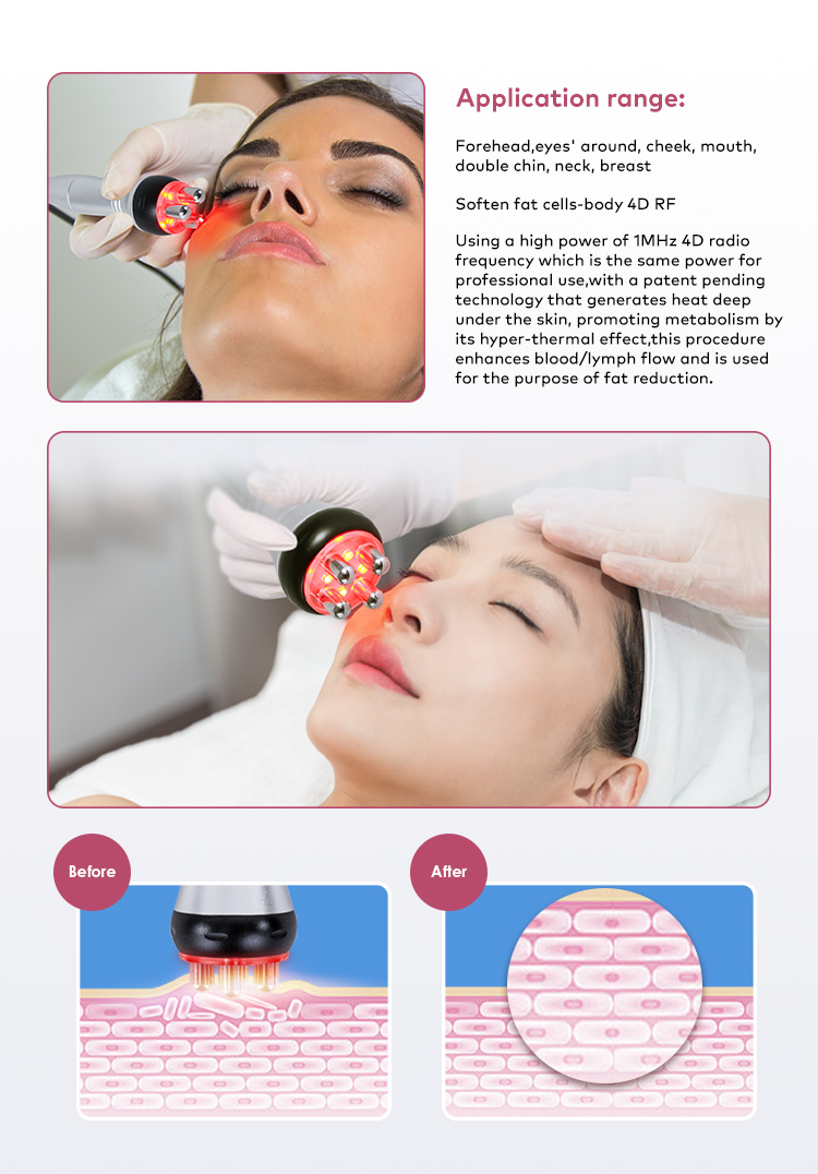 Facial Lifting Application