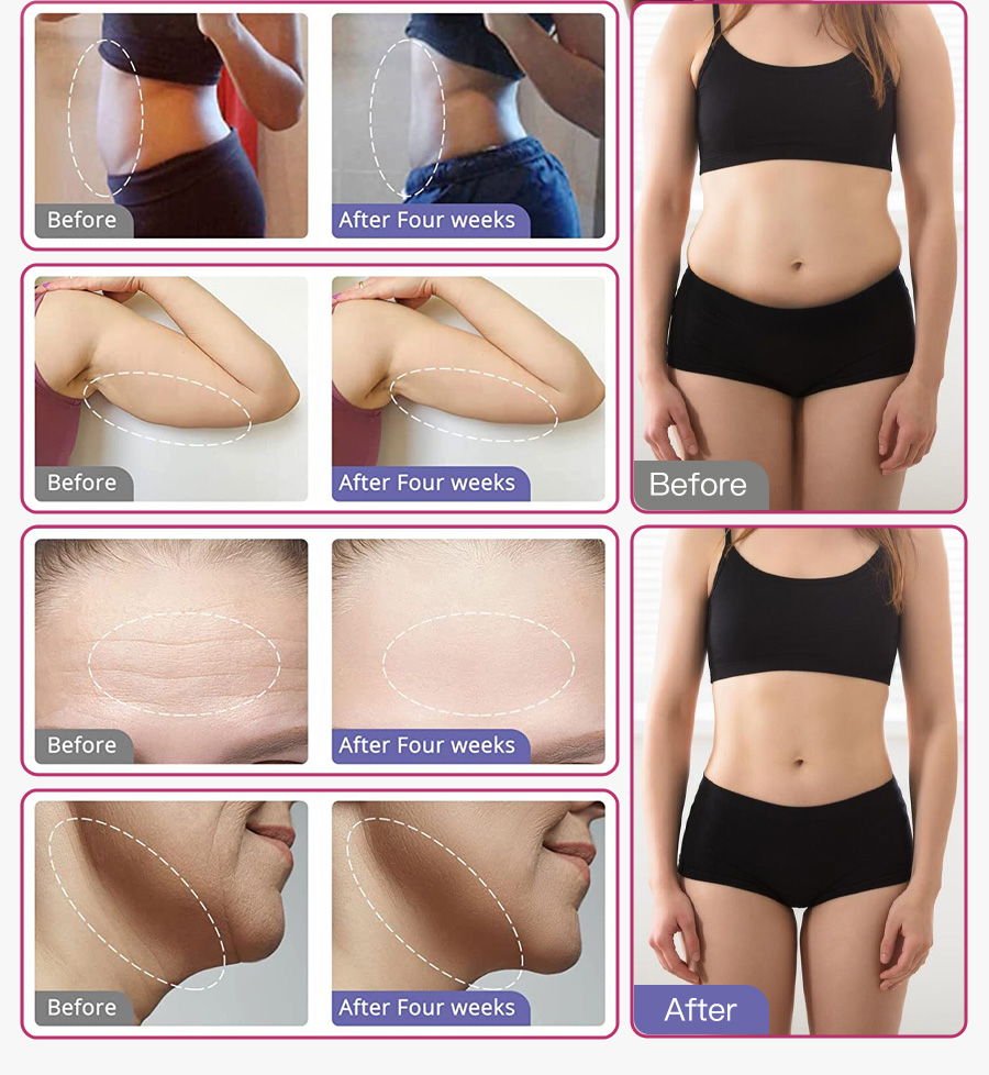 Real Customer Before and After Comparison