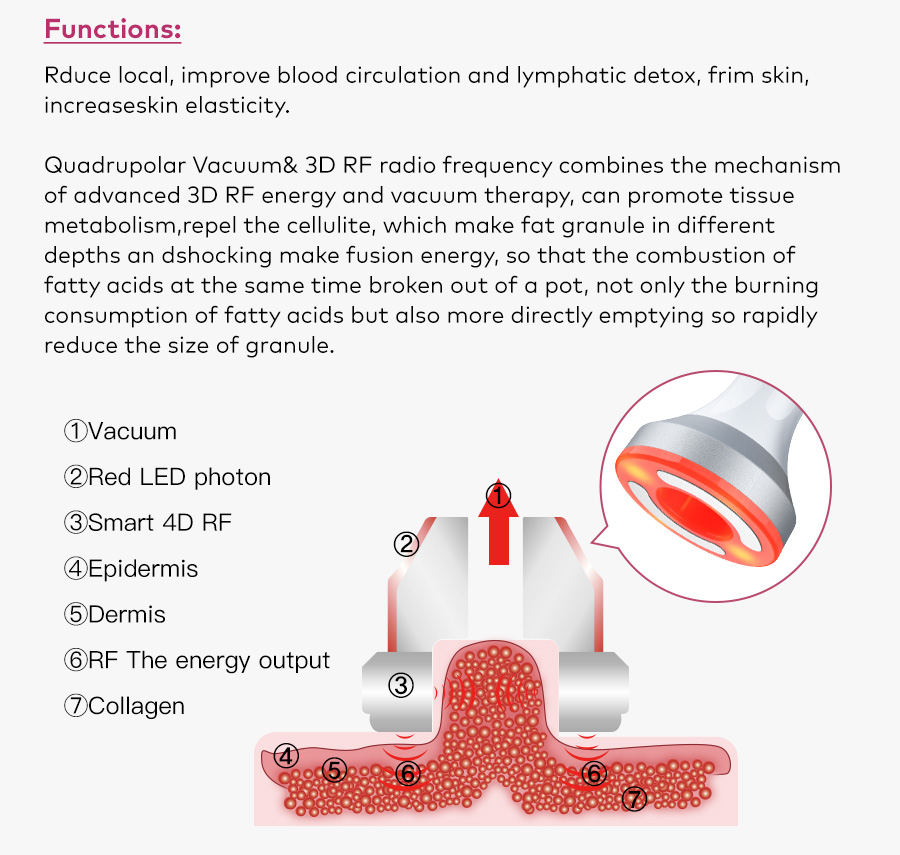 Vacuum RF skin layers and collagen stimulation diagram