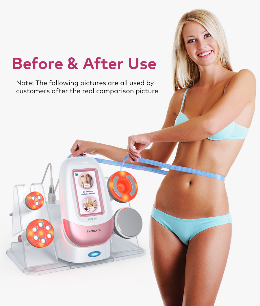 Before and after use of SQ169 body sculpting machine