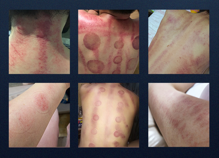 Treatment Results