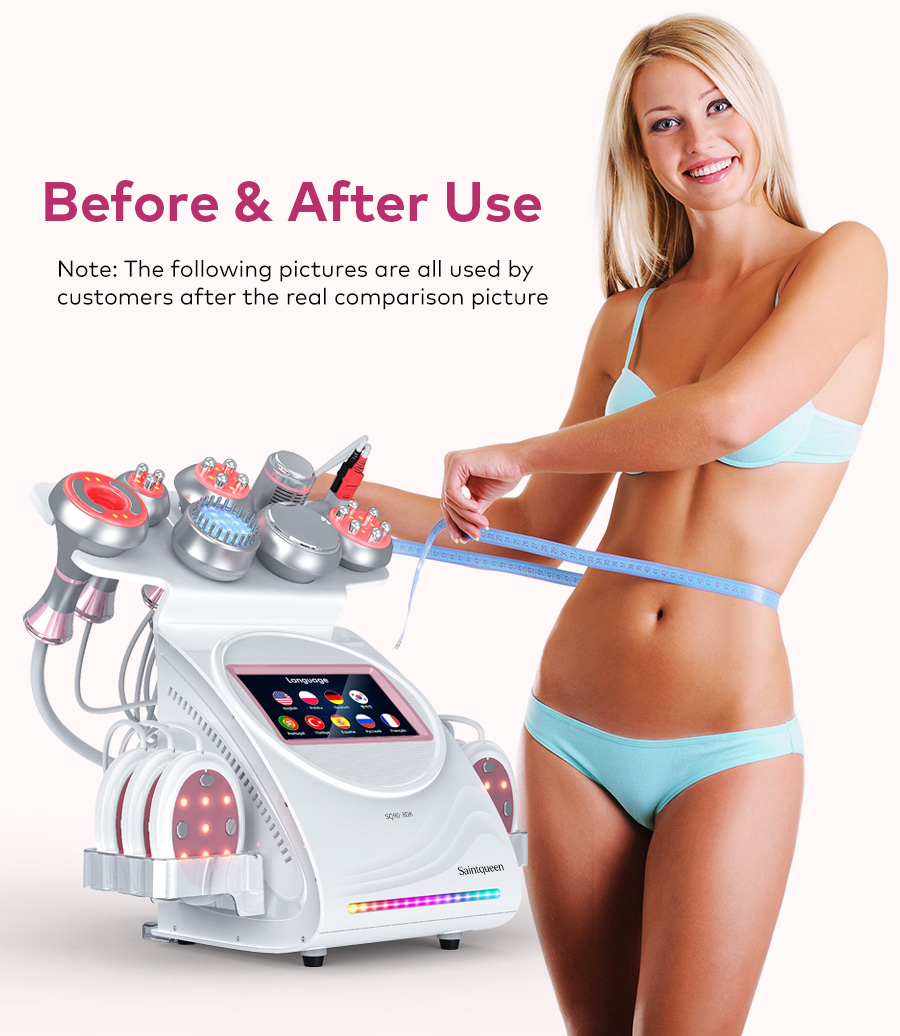 Home beauty device