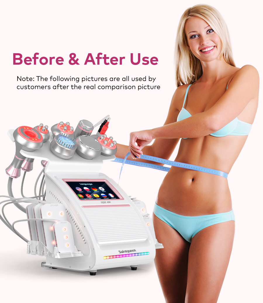 Full handpiece accessory set