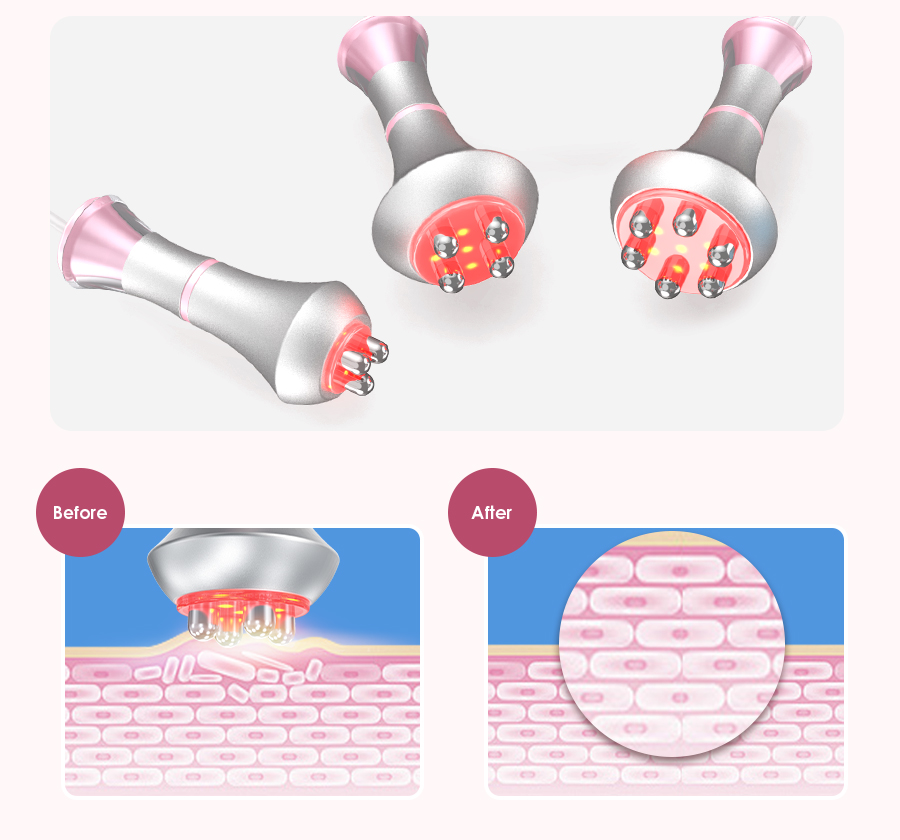 LED meridian brush