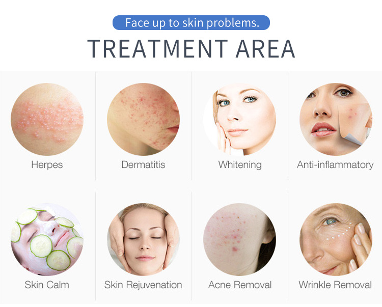 415nm Blue Light Acne Treatment