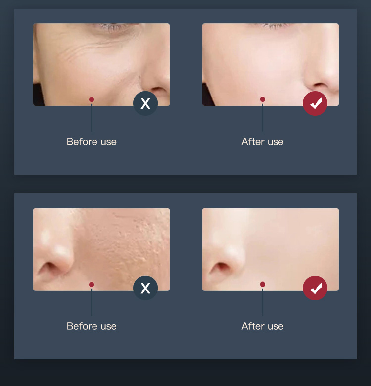 Hot-Compress Mode Tips