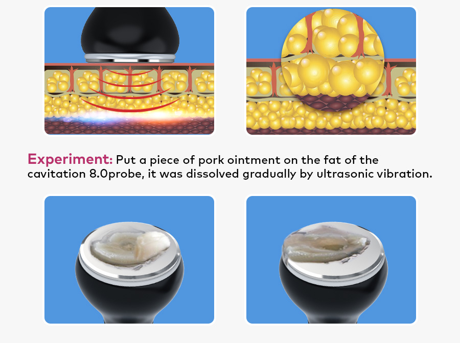Facial & Neck Rejuvenation